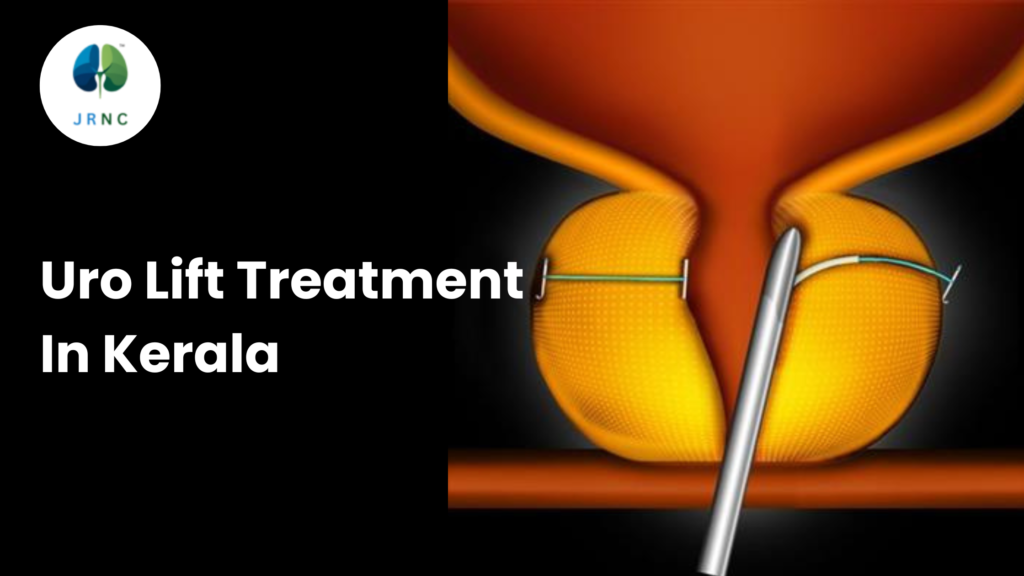 Uro Lift Treatment In Kerala