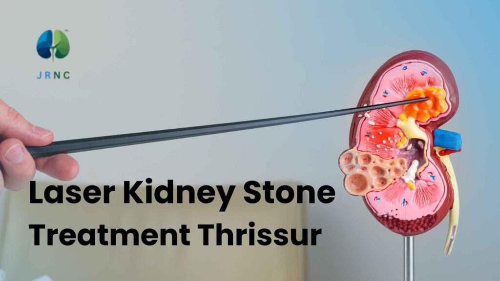 laser kidney stone treatment thrissur