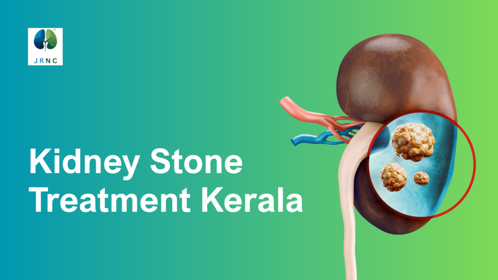 kidney stone treatment Kerala