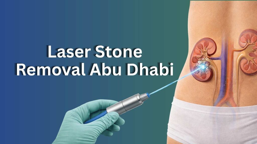 Laser stone removal procedure targeting kidney stones in Abu Dhabi with medical device illustration