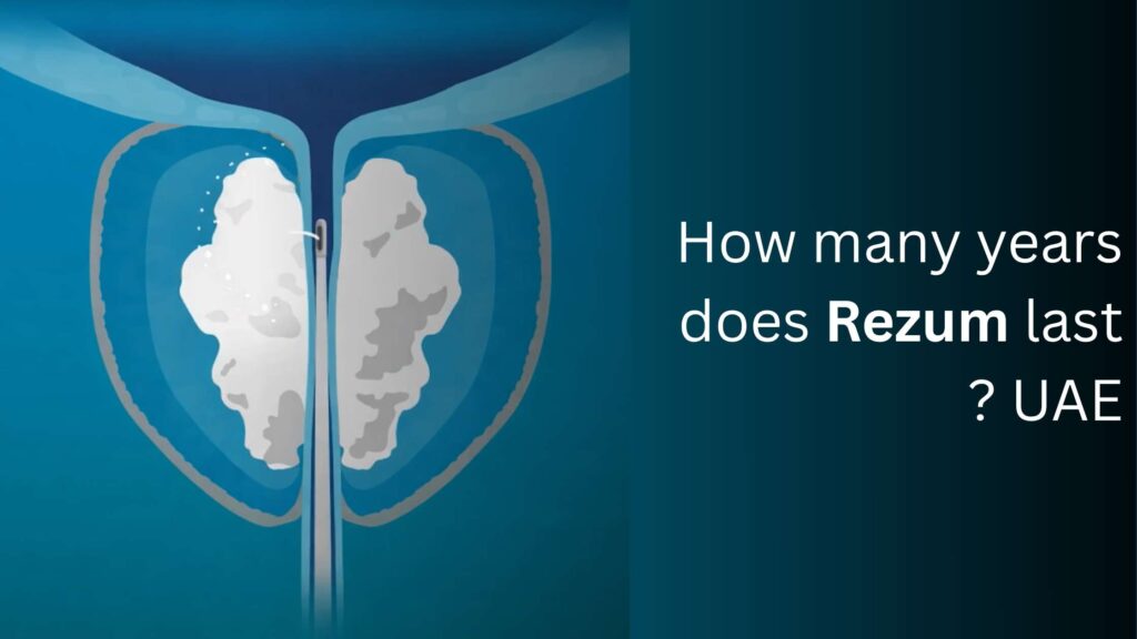 Medical illustration showing the Rezum procedure for benign prostatic hyperplasia (BPH), highlighting how many years Rezum lasts in the UAE.